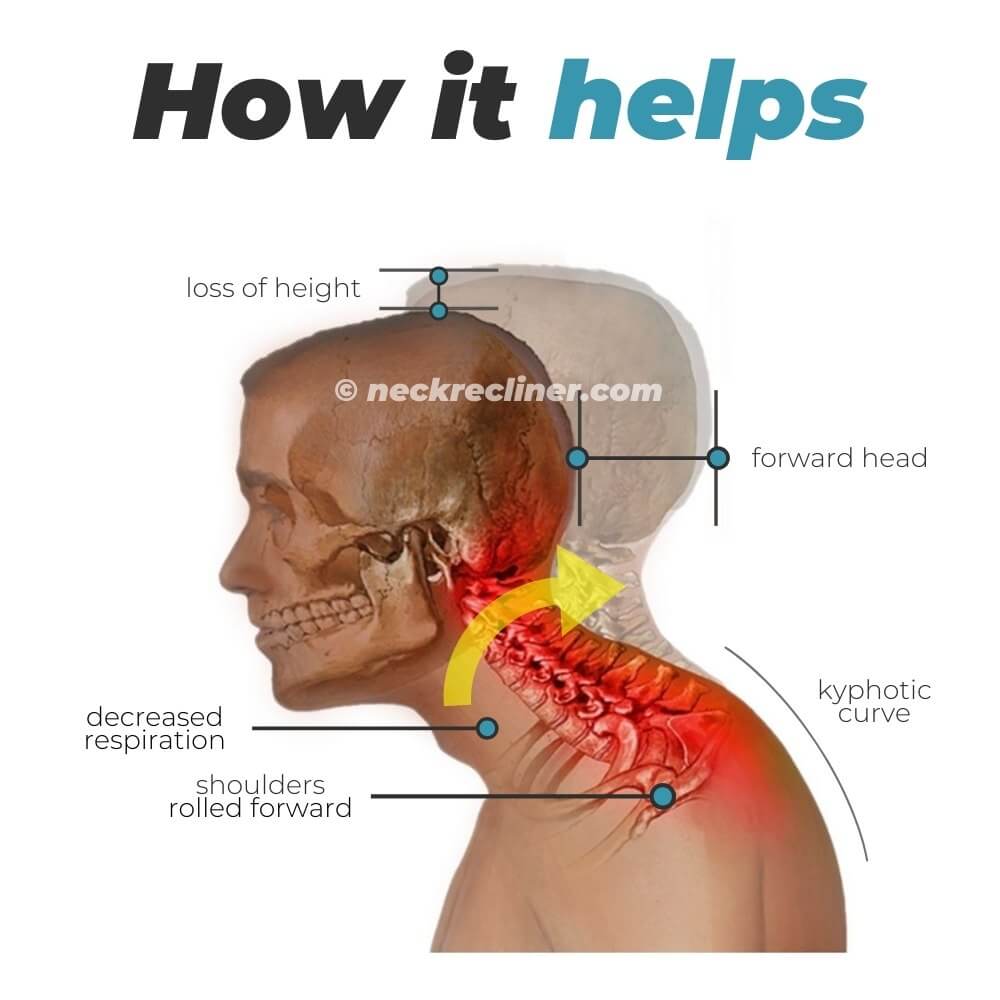 NeckRecliner® DIY Pain-Relief Cervical & Thoracic Stretcher - NeckRecliner