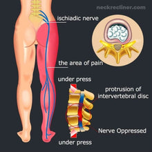 Load image into Gallery viewer, BackRight™️ DIY Pain-Relief Back Stretcher - NeckRecliner
